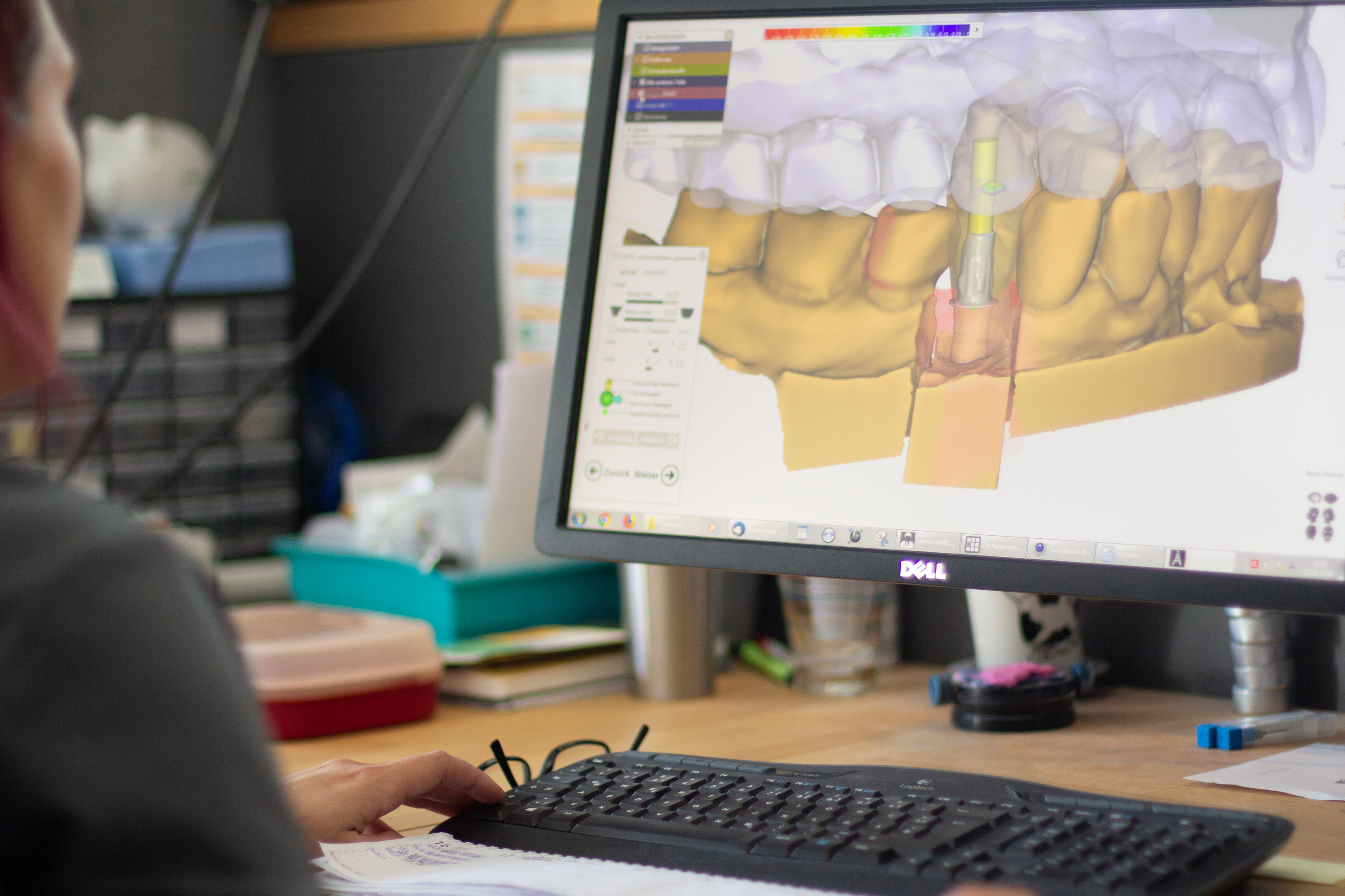 Technikerin bei der Arbeit am PC. Auf dem Display ist das 3D-Modell der Zähne zu erkennen.