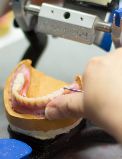 Zahnprothese im Artikulation. Die Prothese wird gerade mit einem Werkzeug bearbeitet.