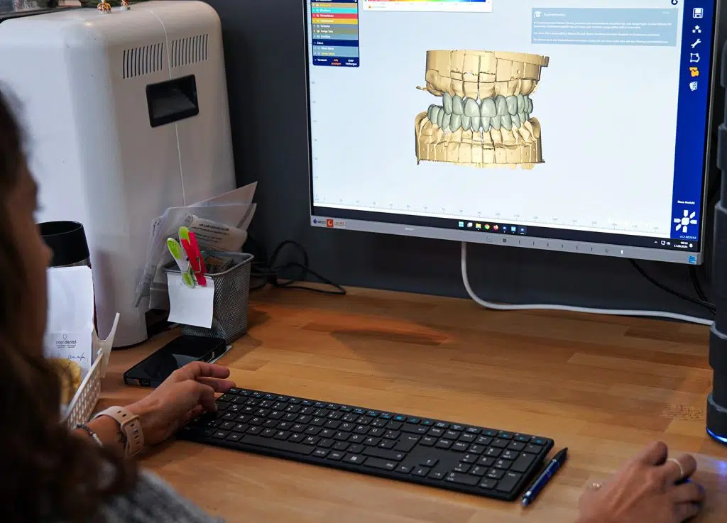 Digitale Konstruktion am Bildschirm im Labor von inter-dental