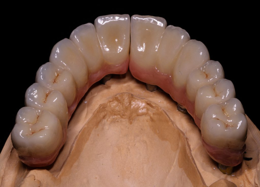 inter-dental - Impressionen