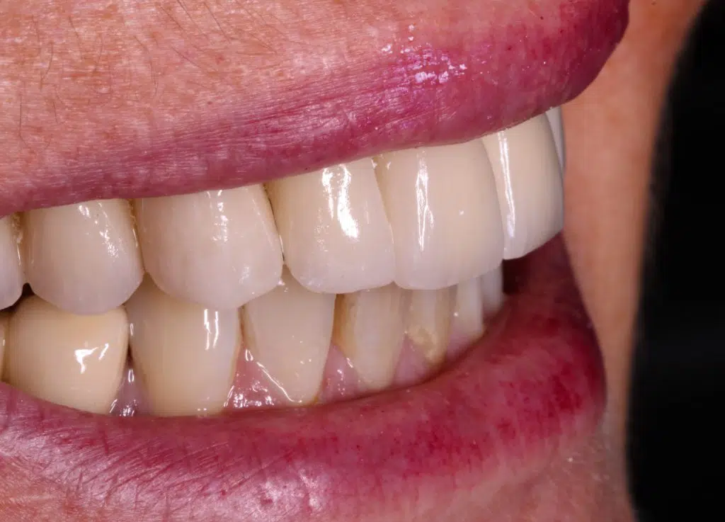 inter-dental - Impressionen